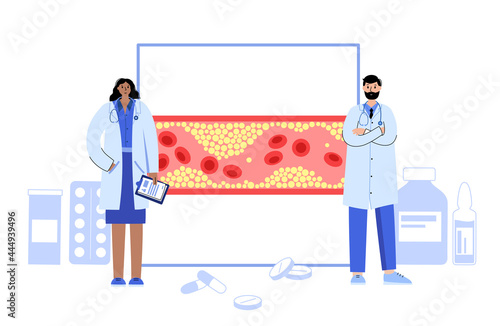 Cholesterol blood artery