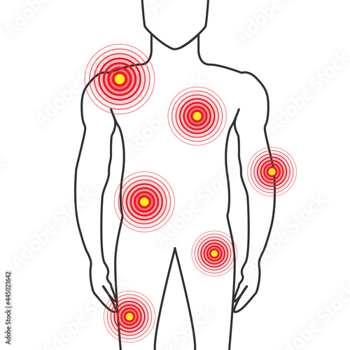 Body Parts Pain Illustration with Shoulders, Chest, Joint, Hips and Muscle Ache on Man