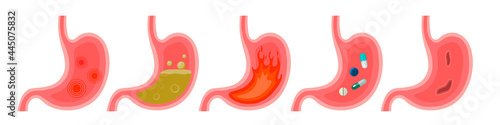 Stomach disease. Stomach pain, gastritis, indigestion, vomiting, heartburn. Vector illustration on white background.