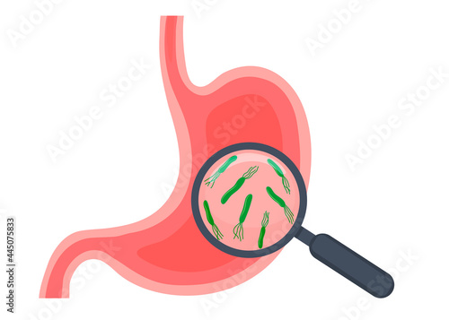 Illustration of a study of the stomach of Helicobacter pylori bacteria. Magnifying glass with bacteria. vector illustration in cartoon style