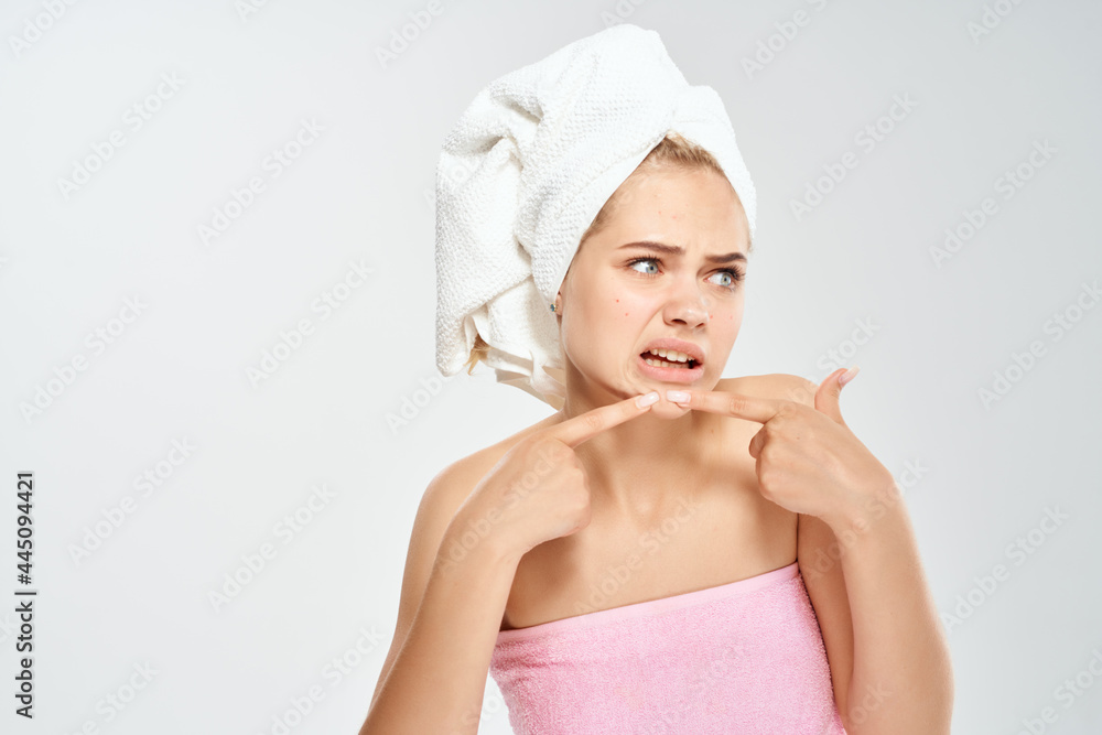 woman with bare shoulders squeezes out pimples on the face dermatology acne woman with bare shoulders squeezes out pimples on the face dermatology acne