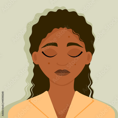 Sad young african american girl is upset about her problem skin, acne, pimples. Vector illustration.