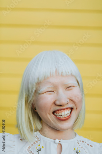 Portrait of a cute albino girl