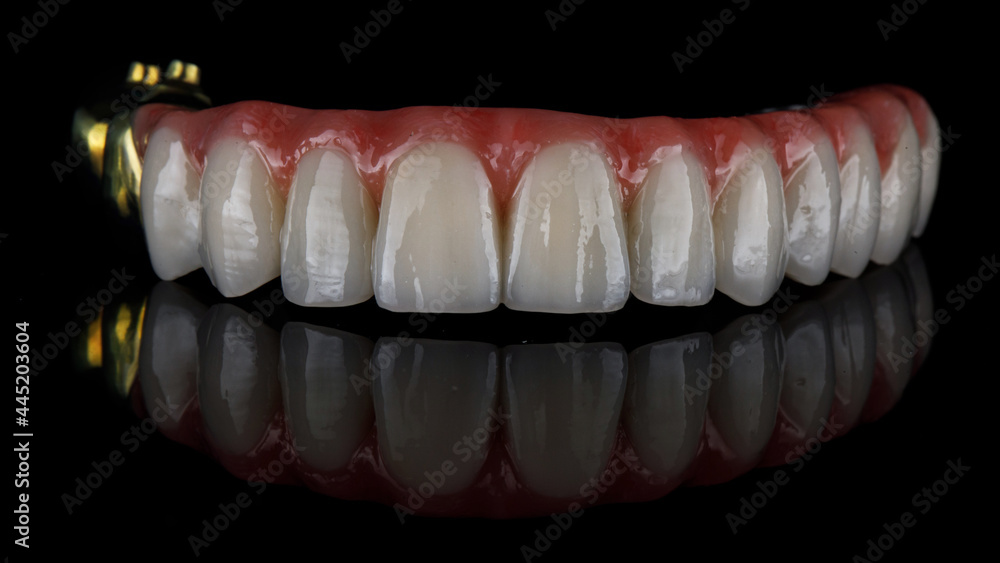 high quality ceramic denture of the upper jaw close-up on black glass