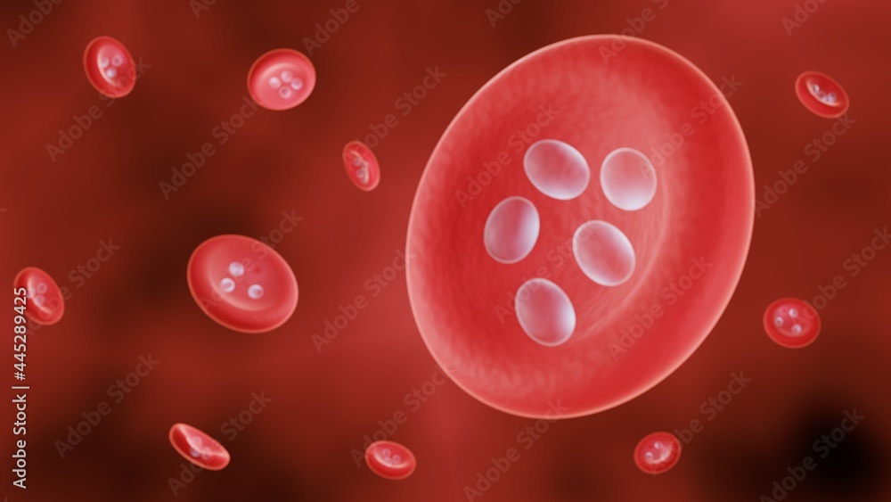 Malaria infection, Plasmodium in a red blood cell Malaria infection, Plasmodium in a red blood cell