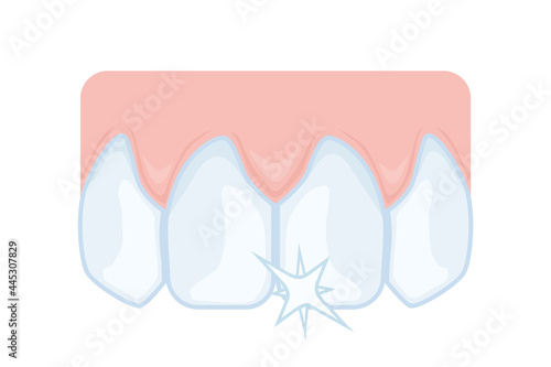 Upper front teeth, incisors. Dentistry, dental care. Vector illustration for study guide or booklet