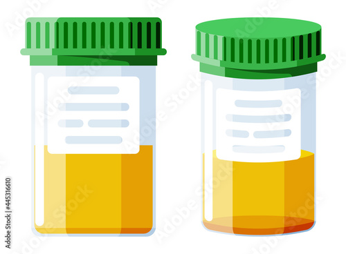 Urine Test Tube Isolated on White.