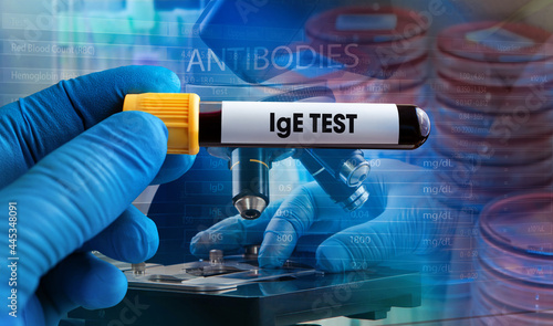 Background with plates with samples and a microscopist analyzing the sample in microscope. Blood sample tube for Immunoglobulin E antibody or IgE level test in blood for diagnosis allergic diseases photo