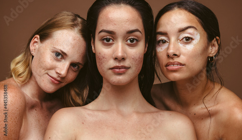 Close up of women with diverse skin types. photo
