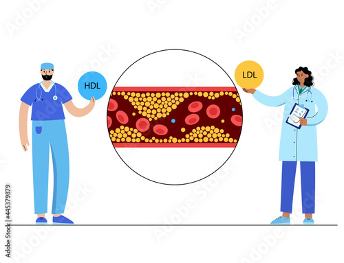 Cholesterol blood artery