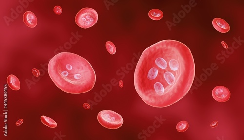 Plasmodium malariae infection, Red blood cells infected by parasites causing malaria photo