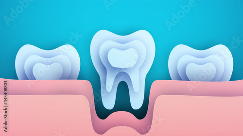 Three white tooth silhouettes in modern creative style. Minimalistic design concept. Healthcare medical composition art element. Paper cut layer vector illustration.