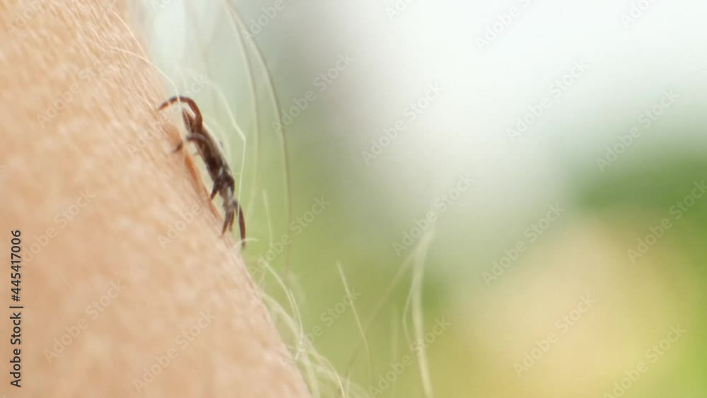 Tick walking on skin - macro shot Tick walking on skin - macro shot
