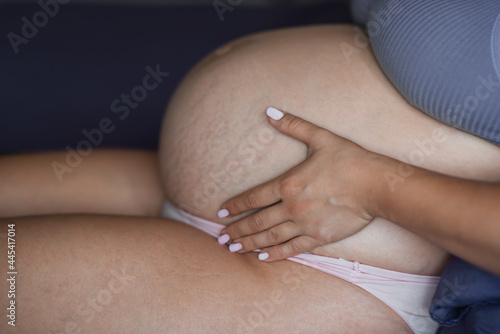 High resolution photo pregnancy. Pregnant woman's stomach is close-up. A woman strokes her stomach. Natural skin texture. Damaged skin with stretches, scars, stripes