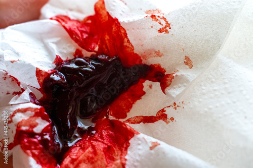 Photo of a period blood clot  photo