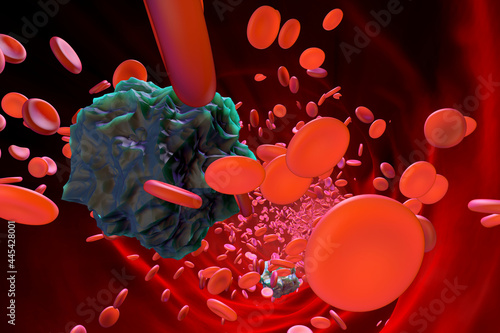 Mutated leukaemia cells in blood stream photo