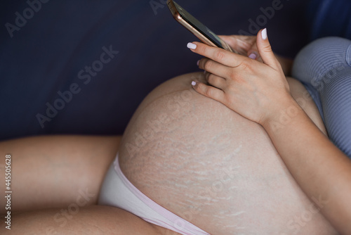 Pregnant woman's stomach is close-up. Natural skin texture. Damaged skin with stretches, scars, stripes