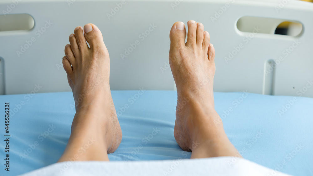 Feet of patient on bed in hospital room. Concept of Guillain barre