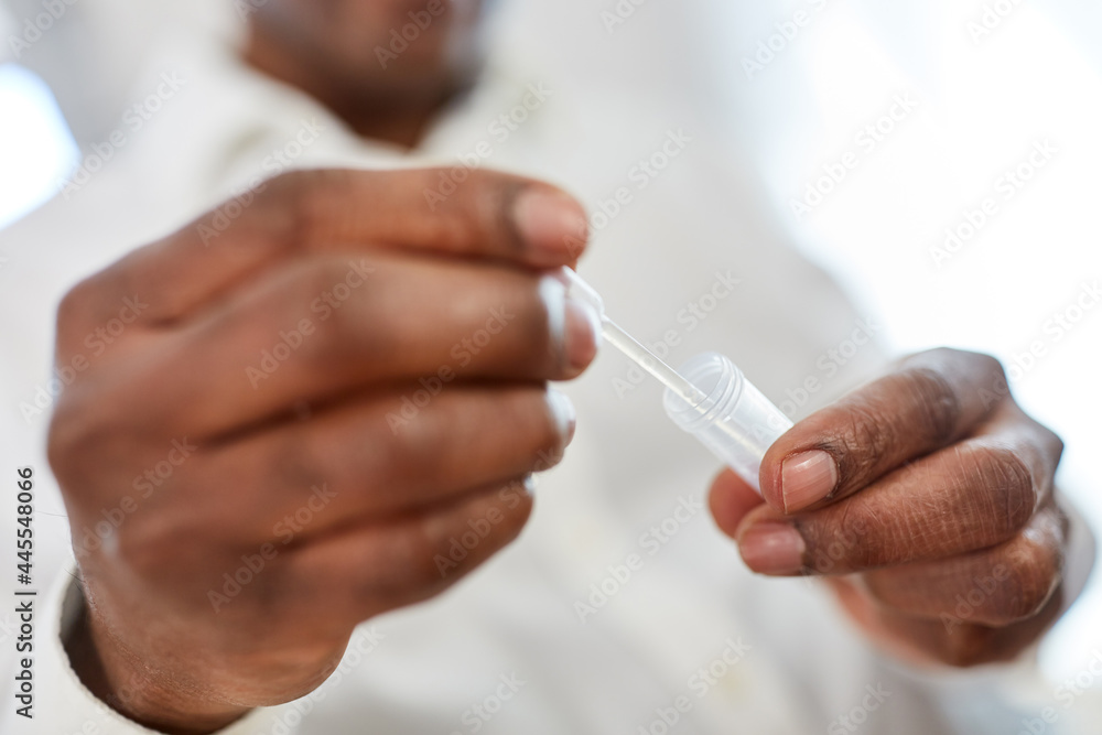 Hands hold pipette with saliva sample for Covid-19 rapid test Hands hold pipette with saliva sample for Covid-19 rapid test