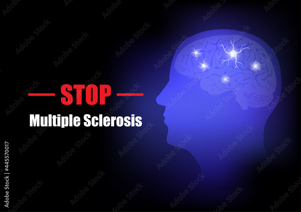 Stop multiple sclerosis. World brain day
