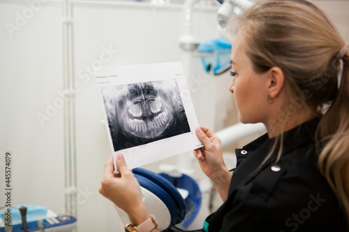 blonde white girl doctor dentist looking at x-ray of the jaw