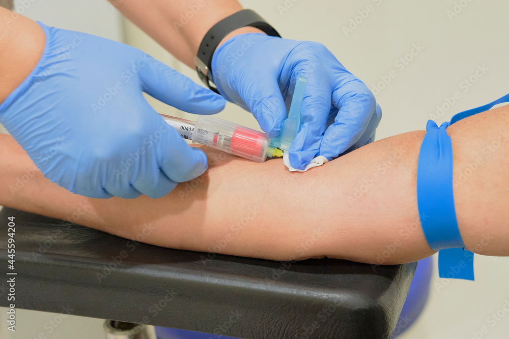 Nurse takes a blood sample, with a prick on the forearm of a patient. Rapid antibody diagnostic procedure.Steps in the process of a serology, antibodies and immunity