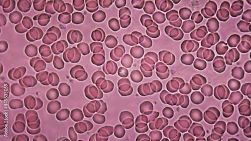 Screening and monitoring of health status. Visual biochemical blood test. Erythrocytes and leukocytes close-up.