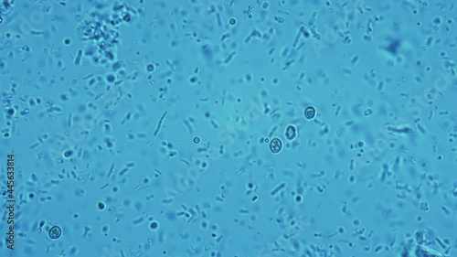 Human dental plaque under a microscope. Thousands of different bacteria are visible in the frame. Staphylococcus, Streptococcus, Candida and yeast bacterias in the frame
