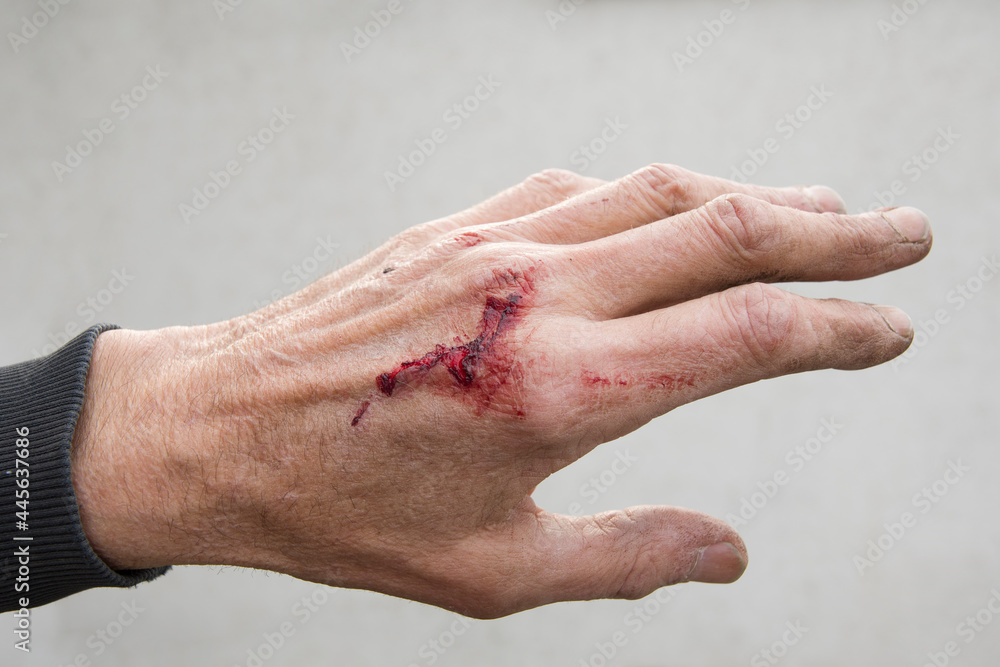 Fototapeta premium bloody and dirty left hand of a working man from the back