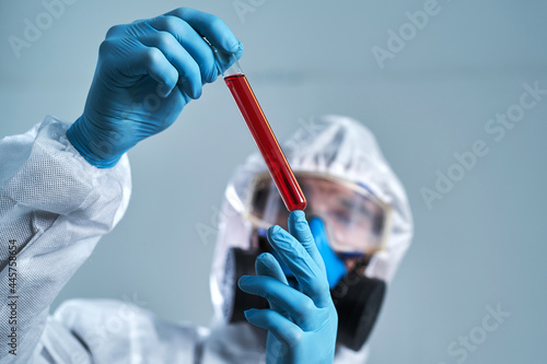 tube with the test results in the hands of a virologist scientist.