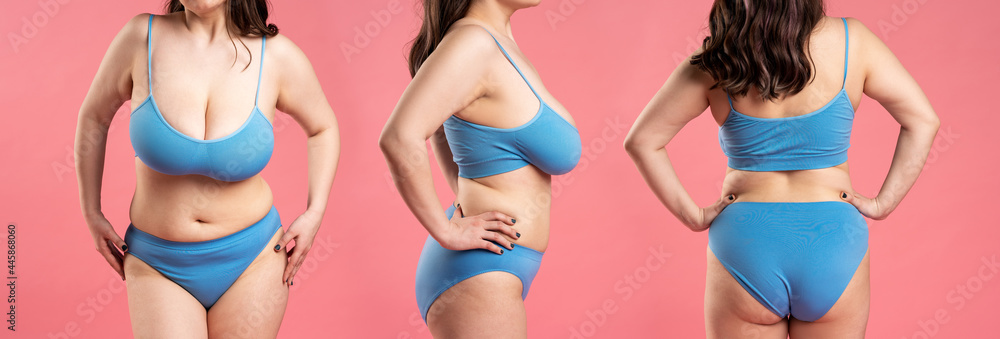 Woman in blue top bra with very large breasts, plastic surgery concept on  pink background, collage of several photos Stock Photo
