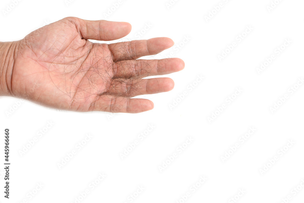 Hair loss, hair loss every day, serious problems and hair loss on a white background. Hair loss, hair loss every day, serious problems and hair loss on a white background.
