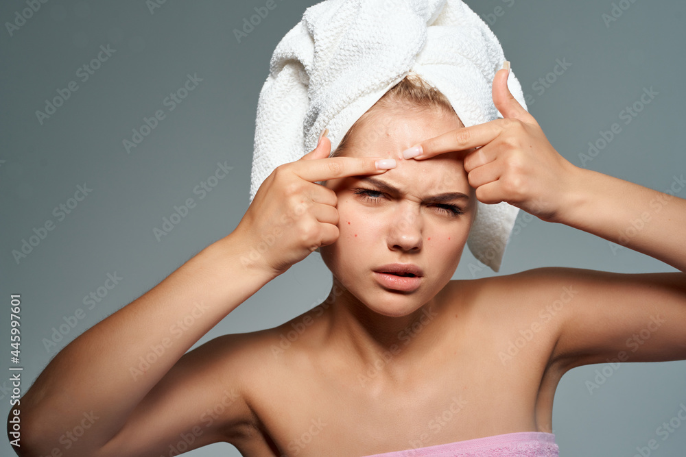 pretty woman with bare shoulders squeeze pimples on her face skin problems pretty woman with bare shoulders squeeze pimples on her face skin problems