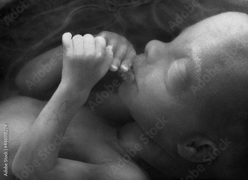 Canvas-taulu Human Fetus