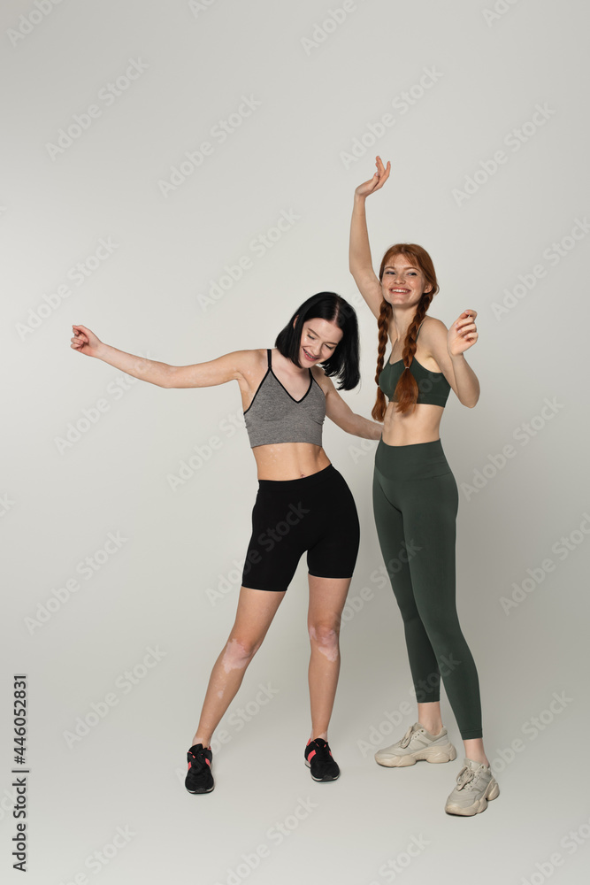 Cheerful young sportswomen with vitiligo and freckles dancing together on grey background Cheerful young sportswomen with vitiligo and freckles dancing together on grey background