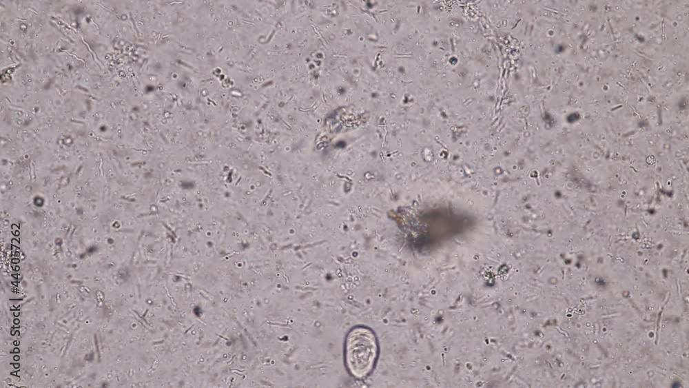 Bacteria and Protozoa in waste water under the microscope.
Bacteria and Protozoa in waste water under the microscope.