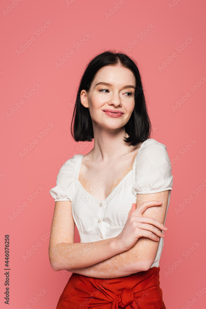 Smiling woman with vitiligo looking away isolated on pink Smiling woman with vitiligo looking away isolated on pink