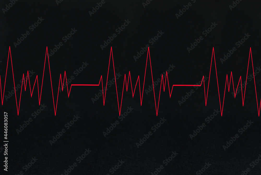 Heart line, diagram on black background