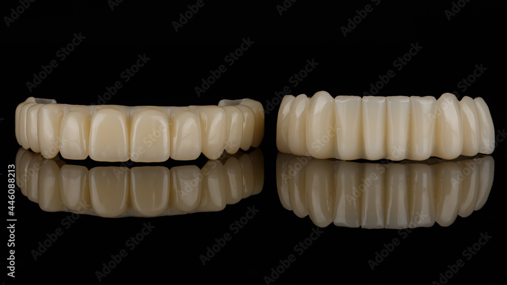 temporary dental prostheses of the upper and lower jaws of milled plastic (polymer) on black glass with reflection temporary dental prostheses of the upper and lower jaws of milled plastic (polymer) on black glass with reflection