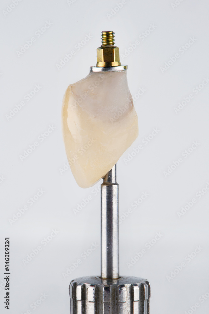 dental crown on an orthopedic screwdriver, on a white background dental crown on an orthopedic screwdriver, on a white background
