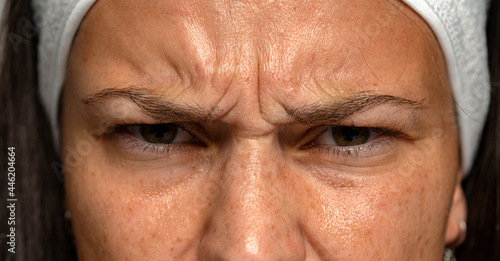  frowning woman with wrinkles on her forehead