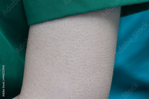 skin on the arm There was a noticeable goosebumps.