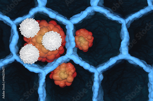 T-cells attack small-cell cancer tumor microbiology 3d illustration top view photo