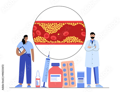 Cholesterol blood artery