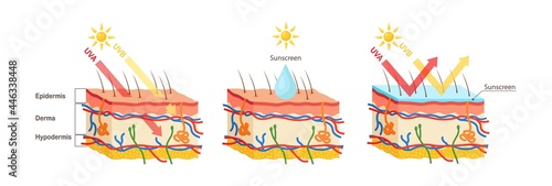 UV protection. Sunscreen lotion protect human skin from UVA, UVB ray. Vector illustration