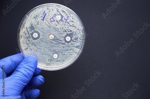 Fotografija Antimicrobial susceptibility by diffusion test