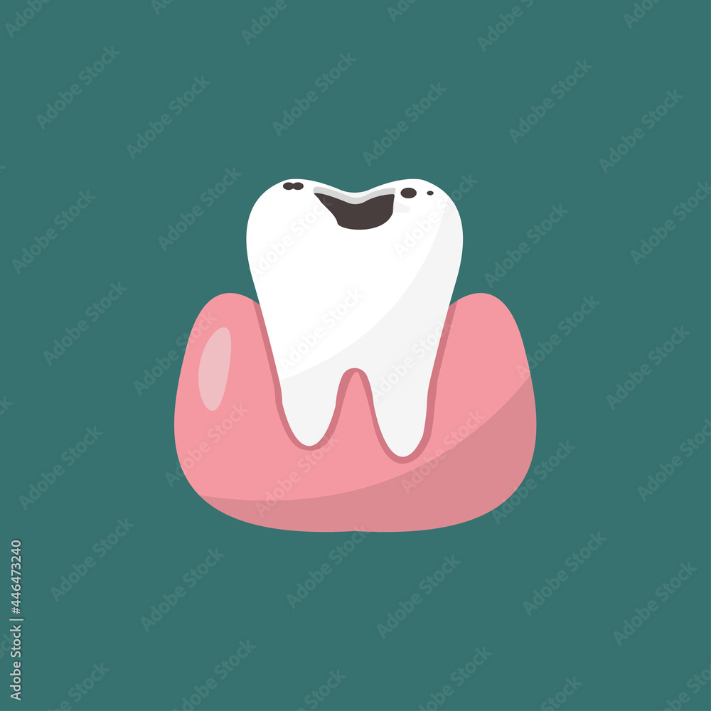 unhealthy teeth plaque and caries hole unhealthy teeth plaque and caries hole