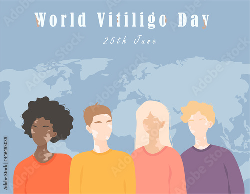 Vector Illustration of people with vitiligo, men and women of different nations with vitiligo. Poster for World vitiligo day, 25 June.