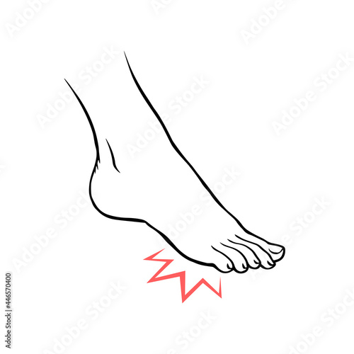 Leg with heel pain. Orthopedic disease. Foot health problems. Vector isolated outline illustration hand drawn
