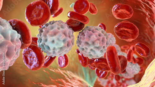 Lymphocytosis, illustration showing abundant white blood cells photo